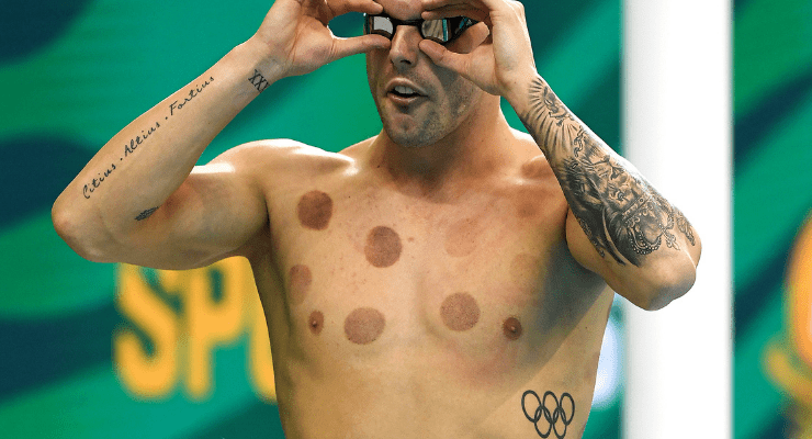 Kyle Chalmers